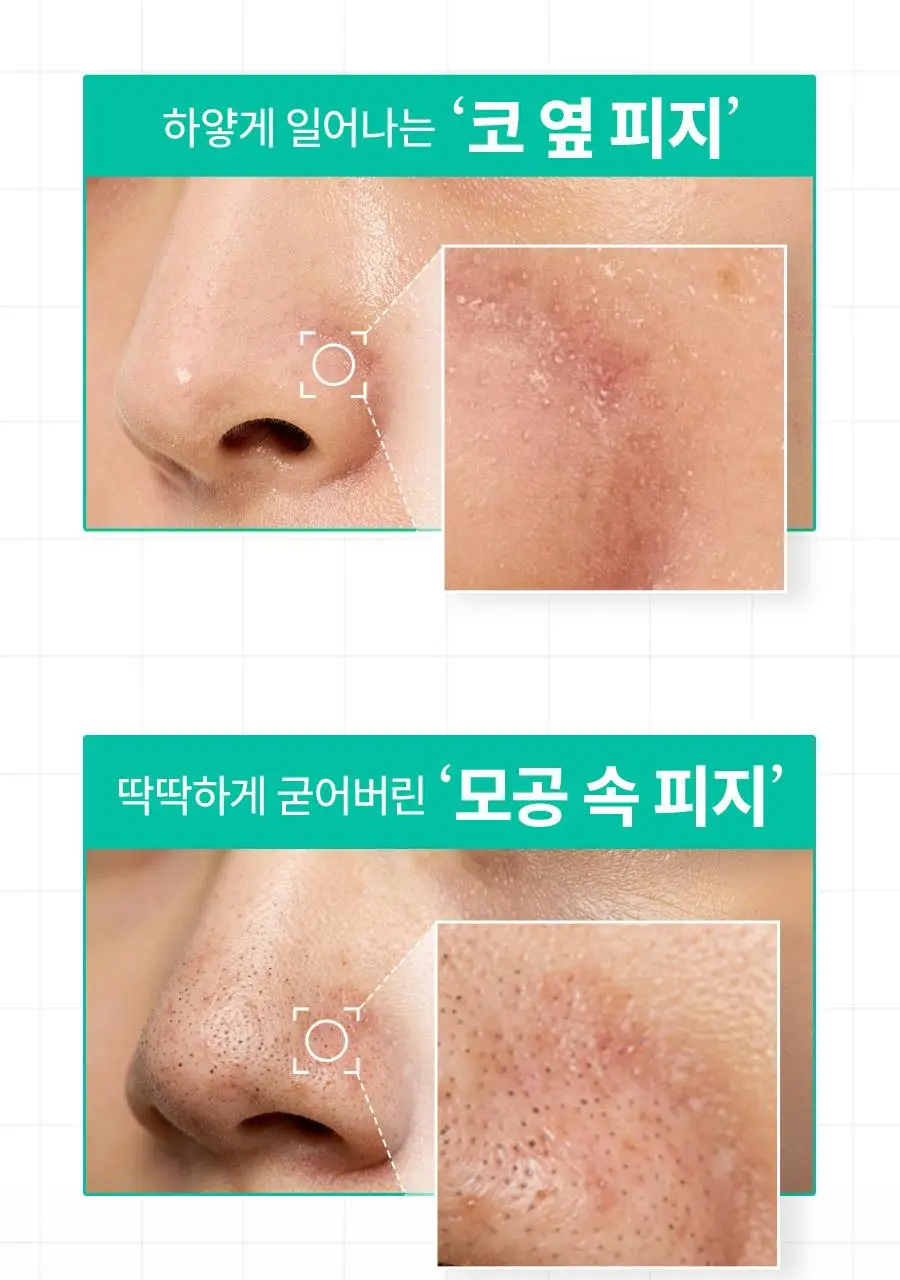 [쫀득팩폼] 한율 피지흡착 쑥떡팩폼 120ml 드롭드롭드롭 기획 (+15ml+카드지갑 키링) 상세페이지 16